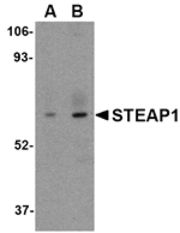 Western blot - STEAP1 Antibody from Signalway Antibody (24565) - Antibodies.com