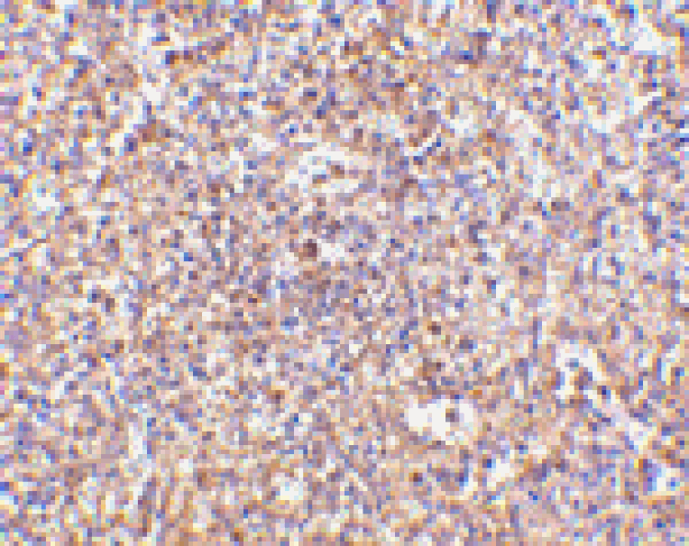 Immunohistochemistry - STEAP1 Antibody from Signalway Antibody (24565) - Antibodies.com
