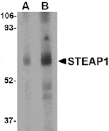 Western blot - STEAP1 Antibody from Signalway Antibody (24566) - Antibodies.com