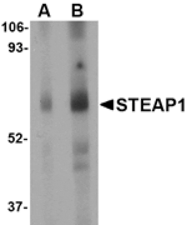 Western blot - STEAP1 Antibody from Signalway Antibody (24566) - Antibodies.com