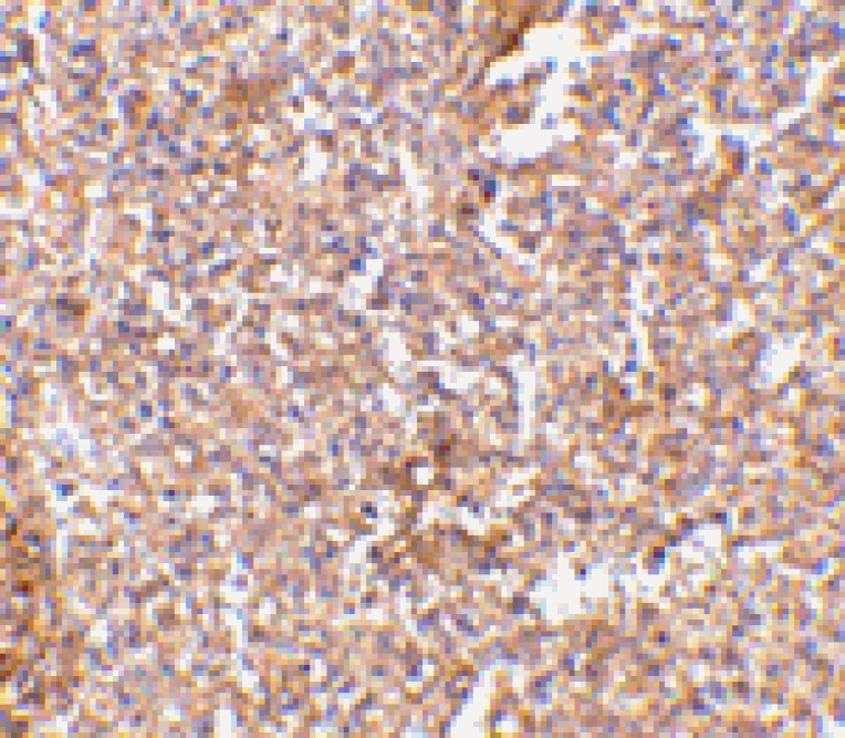 Immunohistochemistry - STEAP1 Antibody from Signalway Antibody (24566) - Antibodies.com