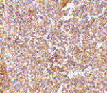 Immunohistochemistry - STEAP1 Antibody from Signalway Antibody (24566) - Antibodies.com