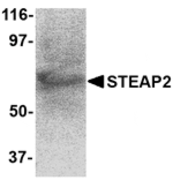Western blot - STEAP2 Antibody from Signalway Antibody (24567) - Antibodies.com