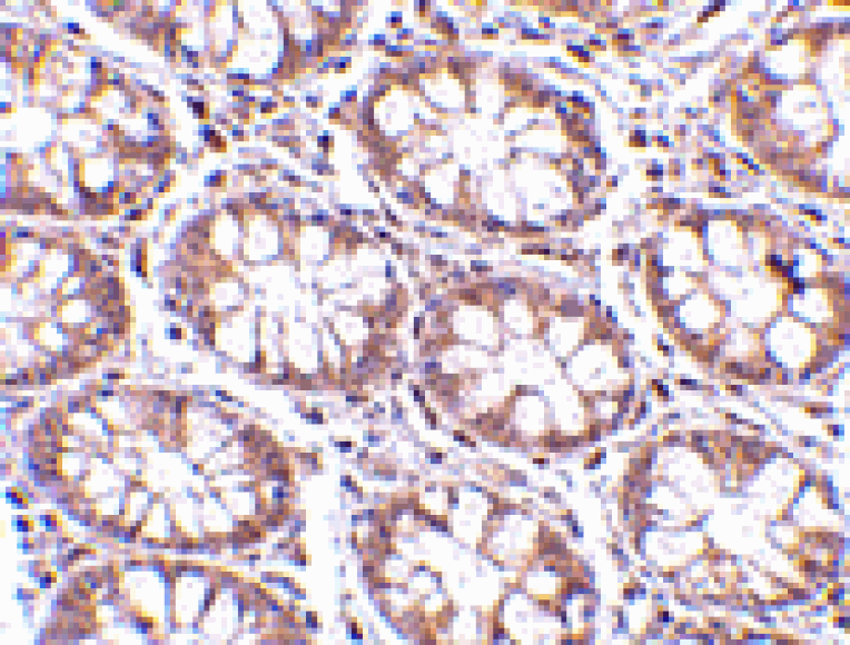 Immunohistochemistry - STEAP2 Antibody from Signalway Antibody (24567) - Antibodies.com