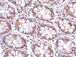 Immunohistochemistry - STEAP2 Antibody from Signalway Antibody (24567) - Antibodies.com