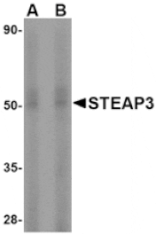 Western blot - STEAP3 Antibody from Signalway Antibody (24568) - Antibodies.com