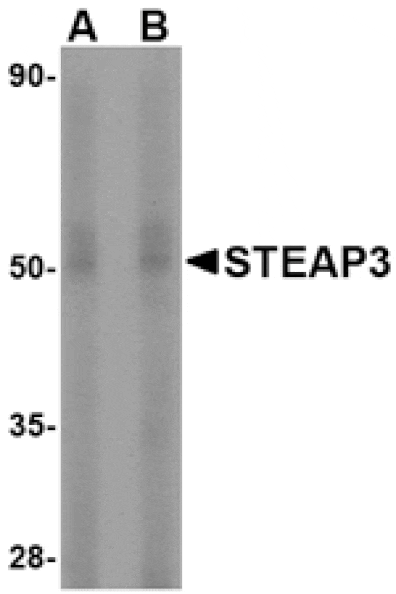 Western blot - STEAP3 Antibody from Signalway Antibody (24568) - Antibodies.com