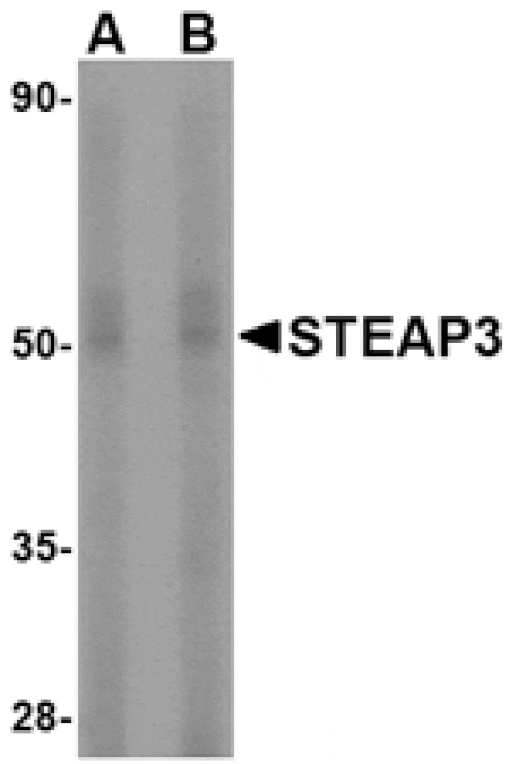 Western blot - STEAP3 Antibody from Signalway Antibody (24568) - Antibodies.com