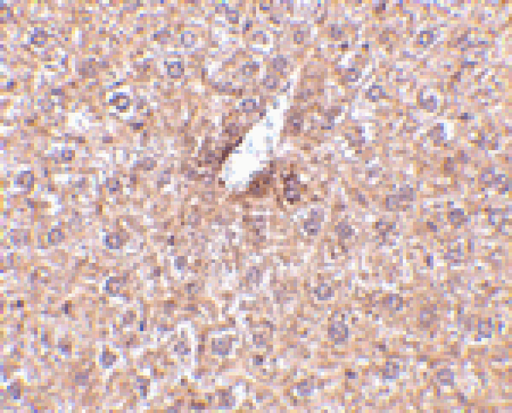 Immunohistochemistry - STEAP3 Antibody from Signalway Antibody (24568) - Antibodies.com