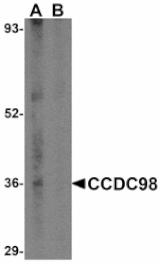 Western blot - CCDC98 Antibody from Signalway Antibody (24572) - Antibodies.com