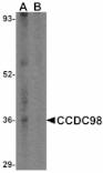 Western blot - CCDC98 Antibody from Signalway Antibody (24572) - Antibodies.com