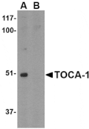 Western blot - TOCA-1 Antibody from Signalway Antibody (24596) - Antibodies.com
