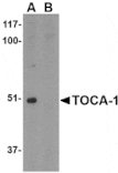 Western blot - TOCA-1 Antibody from Signalway Antibody (24596) - Antibodies.com