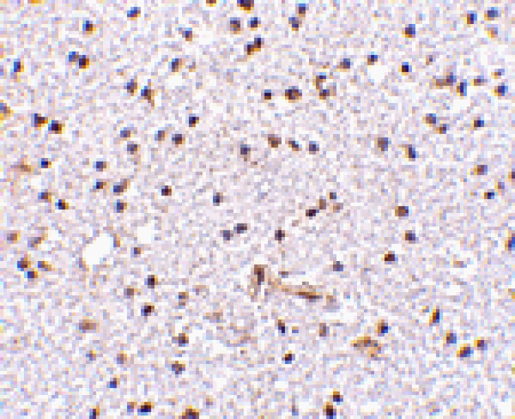 Immunohistochemistry - TOCA-1 Antibody from Signalway Antibody (24596) - Antibodies.com