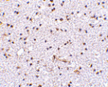 Immunohistochemistry - TOCA-1 Antibody from Signalway Antibody (24596) - Antibodies.com