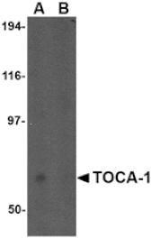Western blot - TOCA-1 Antibody from Signalway Antibody (24597) - Antibodies.com