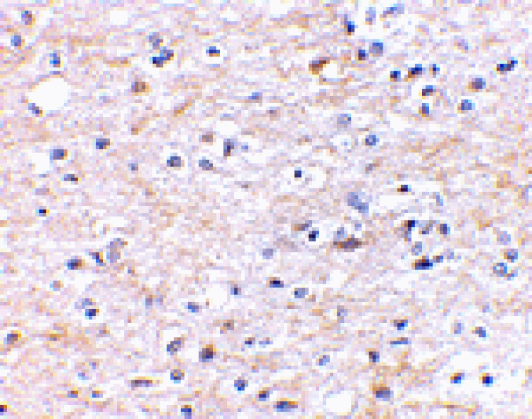 Immunohistochemistry - TOCA-1 Antibody from Signalway Antibody (24597) - Antibodies.com