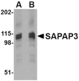 Western blot - SAPAP3 Antibody from Signalway Antibody (24613) - Antibodies.com