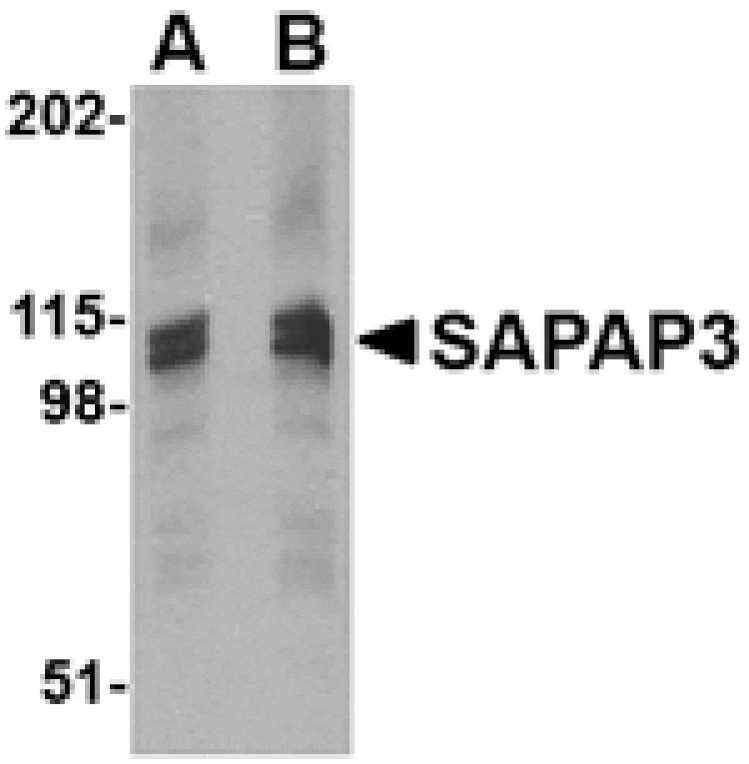 Western blot - SAPAP3 Antibody from Signalway Antibody (24613) - Antibodies.com