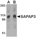 Western blot - SAPAP3 Antibody from Signalway Antibody (24613) - Antibodies.com