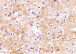 Immunohistochemistry - SAPAP3 Antibody from Signalway Antibody (24613) - Antibodies.com