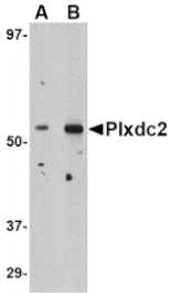 Western blot - Plxdc2 Antibody from Signalway Antibody (24615) - Antibodies.com