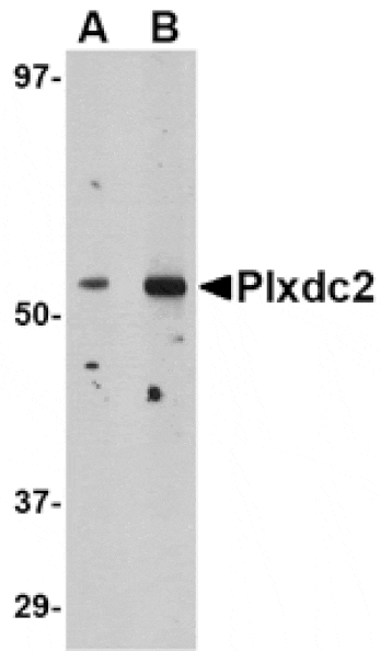 Western blot - Plxdc2 Antibody from Signalway Antibody (24615) - Antibodies.com