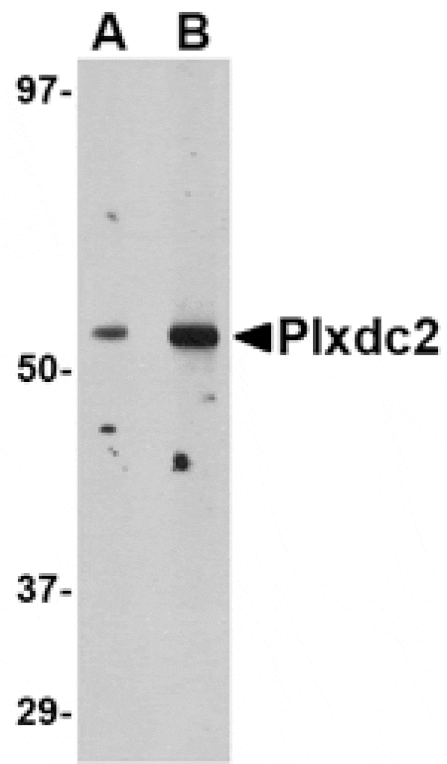 Western blot - Plxdc2 Antibody from Signalway Antibody (24615) - Antibodies.com