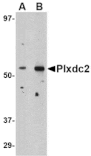 Western blot - Plxdc2 Antibody from Signalway Antibody (24615) - Antibodies.com
