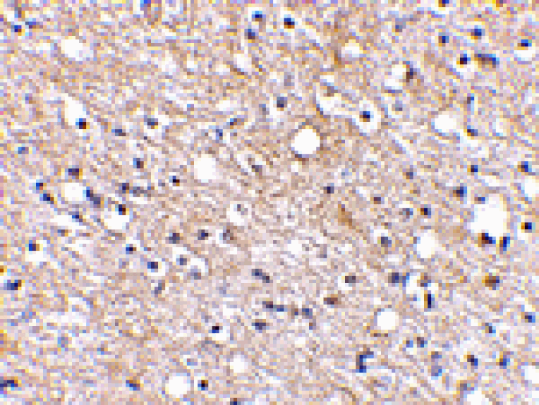 Immunohistochemistry - Plxdc2 Antibody from Signalway Antibody (24615) - Antibodies.com