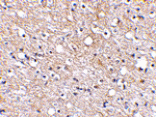 Immunohistochemistry - Plxdc2 Antibody from Signalway Antibody (24615) - Antibodies.com