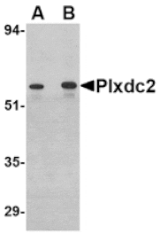 Western blot - Plxdc2 Antibody from Signalway Antibody (24616) - Antibodies.com