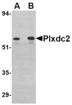 Western blot - Plxdc2 Antibody from Signalway Antibody (24616) - Antibodies.com