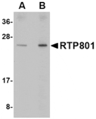 Western blot - RTP801 Antibody from Signalway Antibody (24645) - Antibodies.com