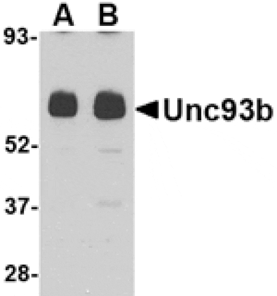 Western blot - Unc93b Antibody from Signalway Antibody (24665) - Antibodies.com