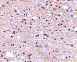 Immunohistochemistry - Ambra1 Antibody from Signalway Antibody (24666) - Antibodies.com