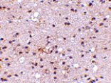 Immunohistochemistry - Ambra1 Antibody from Signalway Antibody (24667) - Antibodies.com