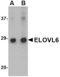 Western blot - ELOVL6 Antibody from Signalway Antibody (24672) - Antibodies.com