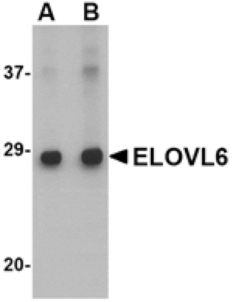 Western blot - ELOVL6 Antibody from Signalway Antibody (24672) - Antibodies.com