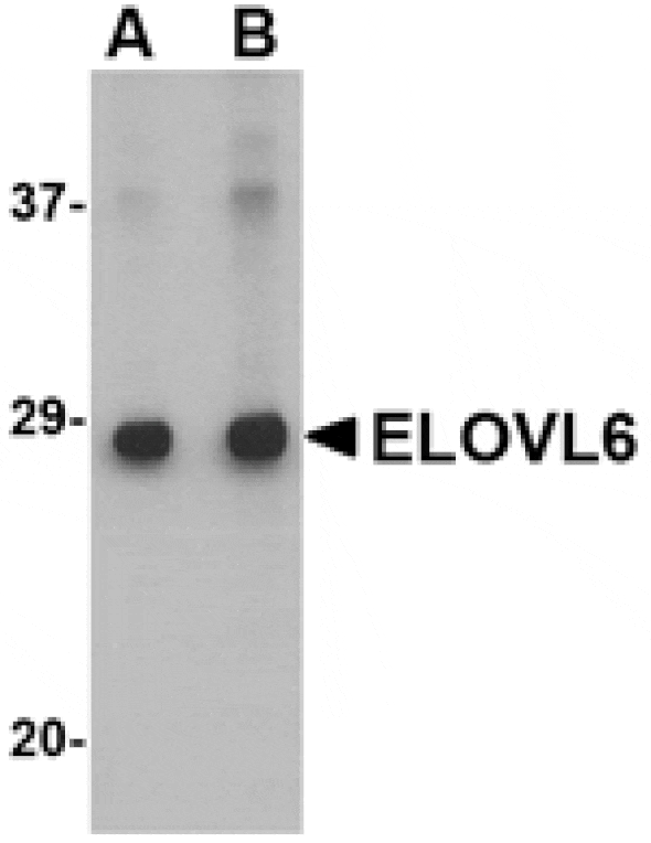 Western blot - ELOVL6 Antibody from Signalway Antibody (24672) - Antibodies.com