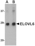 Western blot - ELOVL6 Antibody from Signalway Antibody (24672) - Antibodies.com