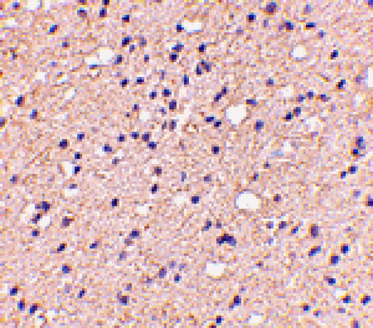 Immunohistochemistry - ELOVL6 Antibody from Signalway Antibody (24672) - Antibodies.com