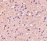 Immunohistochemistry - ELOVL6 Antibody from Signalway Antibody (24672) - Antibodies.com