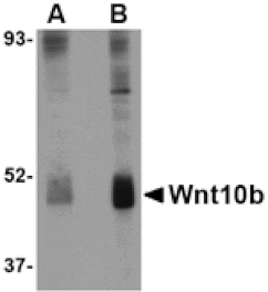 Western blot - Wnt10b Antibody from Signalway Antibody (24690) - Antibodies.com