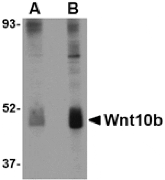 Western blot - Wnt10b Antibody from Signalway Antibody (24690) - Antibodies.com