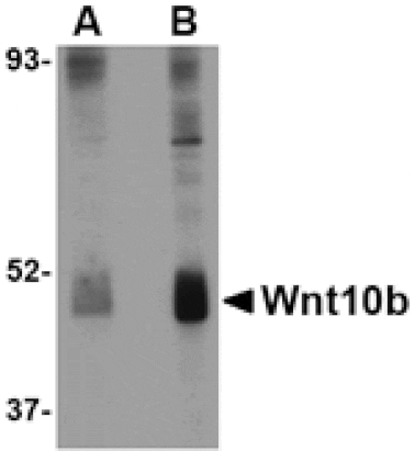 Western blot - Wnt10b Antibody from Signalway Antibody (24690) - Antibodies.com
