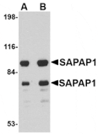 Western blot - SAPAP1 Antibody from Signalway Antibody (24692) - Antibodies.com