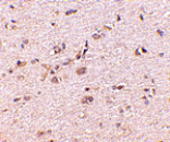 Immunohistochemistry - SAPAP1 Antibody from Signalway Antibody (24692) - Antibodies.com