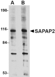 Western blot - SAPAP2 Antibody from Signalway Antibody (24693) - Antibodies.com