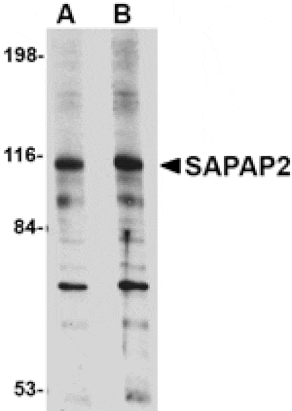 Western blot - SAPAP2 Antibody from Signalway Antibody (24693) - Antibodies.com